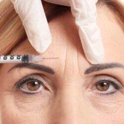 treatment-wrinkle