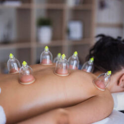 Acupuncture Clinic Lakewood