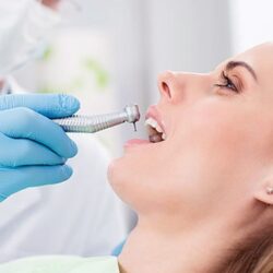 Teeth Whitening Strathpine