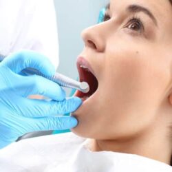 root-canal-treatment
