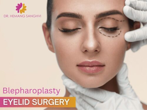 Blepharoplasty eyelid surgeon in mumbai Blepharoplasty eyelid surgeon in mumbai