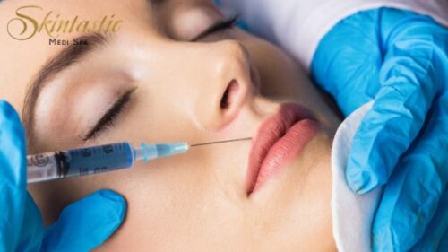 Lip Fillers Riverside for Natural Beauty Lip Fillers Riverside for Natural Beauty