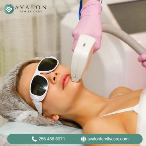 LASER HAIR REMOVE1 LASER HAIR REMOVE1