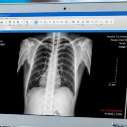 Xray