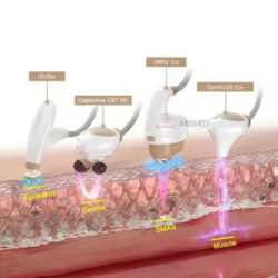 HIFU Treatment in Chandigarh for Youthful Skin Tightening