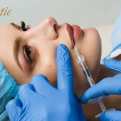 Lip Fillers Riverside for Beautiful Lip Enhancement