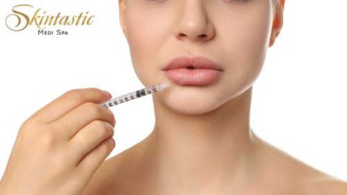 Premium Lip Fillers Riverside Premium Lip Fillers Riverside