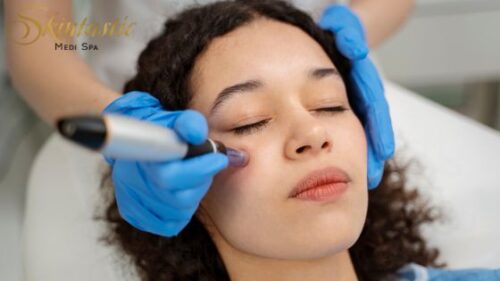 Potenza Microneedling Near Me in Riverside Potenza Microneedling Near Me in Riverside