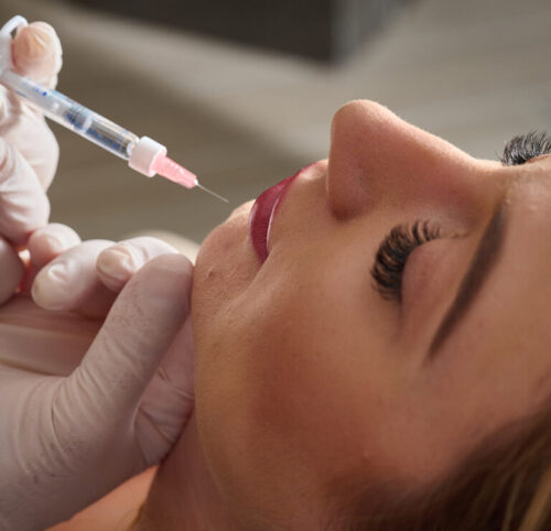 lip fillers 1 lip fillers 1
