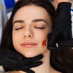 Top Hydrafacial in Riverside for Glowing