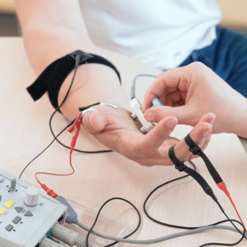 Electromyography Electromyography
