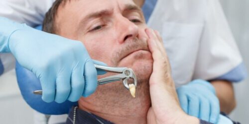 Tooth Extraction Services Tooth Extraction Services