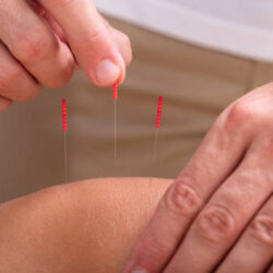 chronic pain treatment san Francisco