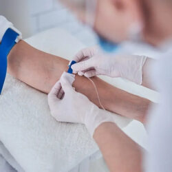 iv-therapy
