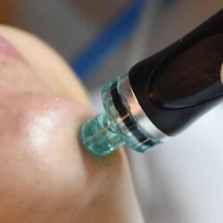 Best Hydrafacial in Chandigarh for Radiant Skin