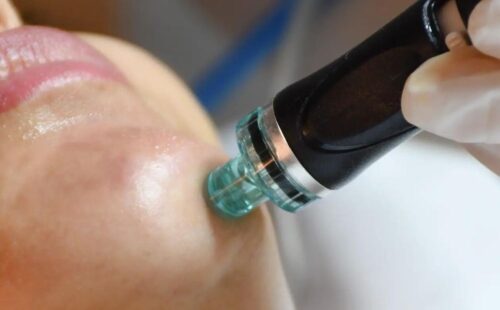 Best Hydrafacial in Chandigarh for Radiant Skin Best Hydrafacial in Chandigarh for Radiant Skin