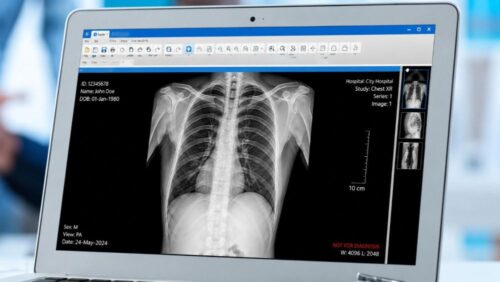 Xray Xray