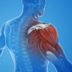 Shoulder Impingement in Gurgaon