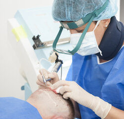 hair transplant clinic in uk
