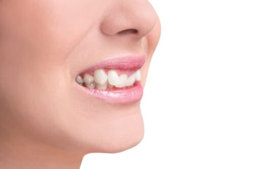 Crooked-Teeth Crooked-Teeth