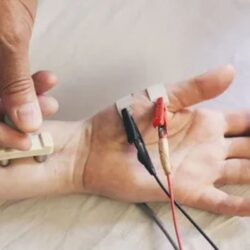 EMG NCV
