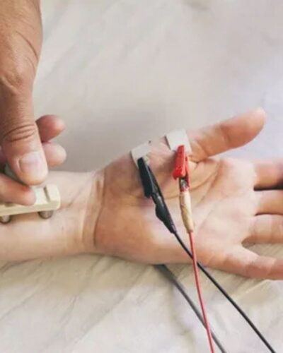 EMG NCV EMG NCV