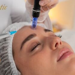 Potenza Microneedling