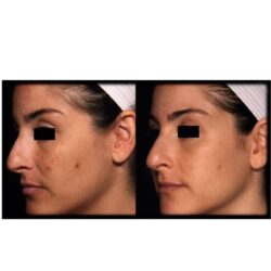 skincarelasercentre clasi 2