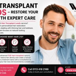 Hair Transplant in Leeds