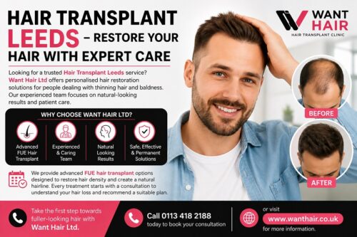 Hair Transplant in Leeds Hair Transplant in Leeds