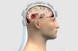 Traumatic Brain Injury Treatment in Gurgaon