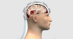 Traumatic Brain Injury Treatment in Gurgaon Traumatic Brain Injury Treatment in Gurgaon