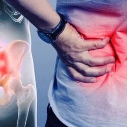 SIJ Joint Dysfunction in Gurgaon