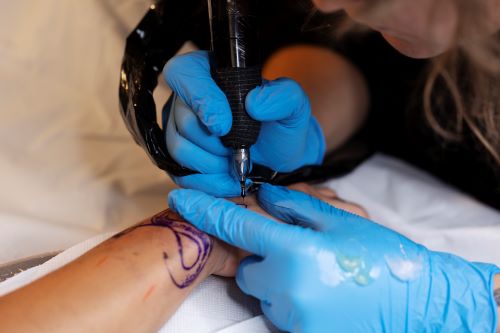 Saline Removal Tattoo Saline Removal Tattoo