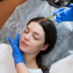 PRP Therapy Etobicoke