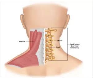 Cervical Spondylosis Treatment Cervical Spondylosis Treatment