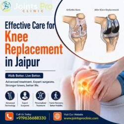 Effective Care for Knee Replacement in Jaipur (1)