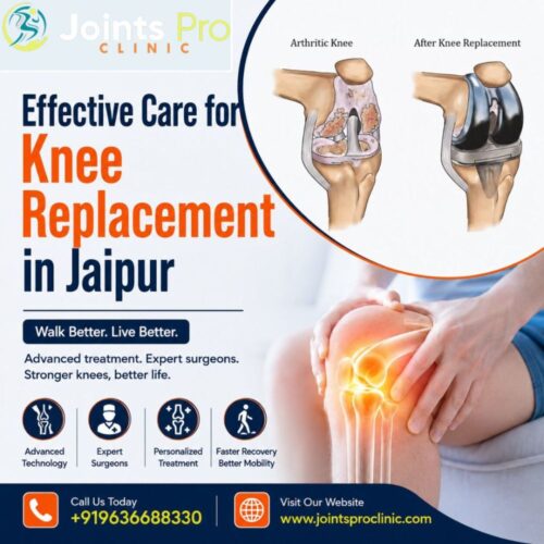 Effective Care for Knee Replacement in Jaipur (1) Effective Care for Knee Replacement in Jaipur (1)