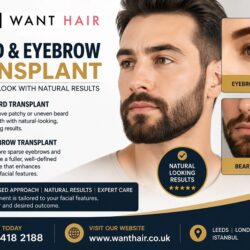 Beard & Eyebrow Transplant