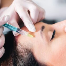 Collagen Stimulator Treatment in Dubai