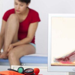 Podiatrist Sydney CBD