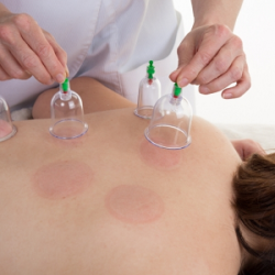 Cupping-Central-Nebraska-1