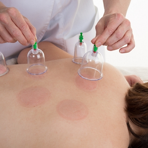 Cupping-Central-Nebraska-1 Cupping-Central-Nebraska-1