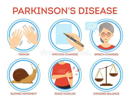 Parkinson’s Disease Treatment Parkinson’s Disease Treatment