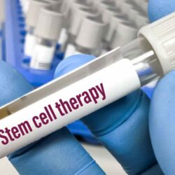 Stem cell therapy in Clarksville