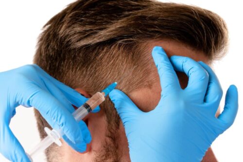 GFC Treatment in Bengaluru Near Me GFC Treatment in Bengaluru Near Me