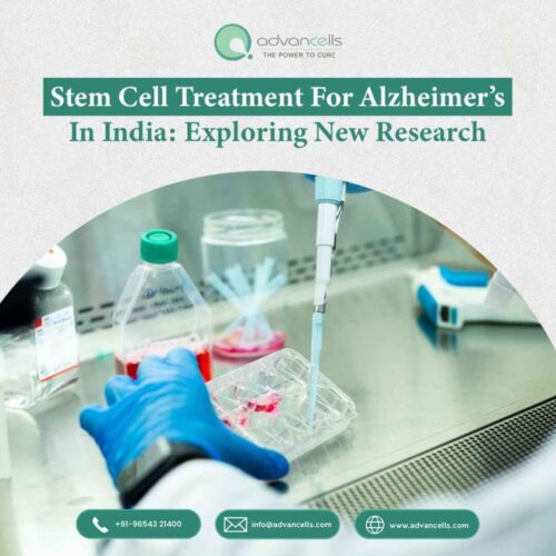 Stem Cell Treatment for Alzheimer’s in India Stem Cell Treatment for Alzheimer’s in India