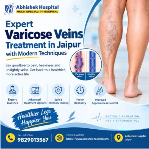 Expert Varicose Veins Treatment in Jaipur with Modern Techniques Expert Varicose Veins Treatment in Jaipur with Modern Techniques