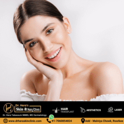Melasma Treatment in Roorkee