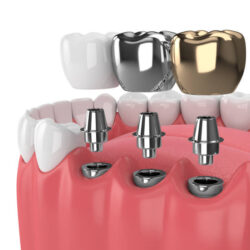 Best Dentist in Madurai for Complete Dental Care Solutions
